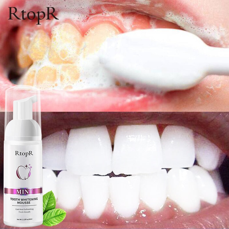 Tooth Whitening Mousse - blossombellabeauty